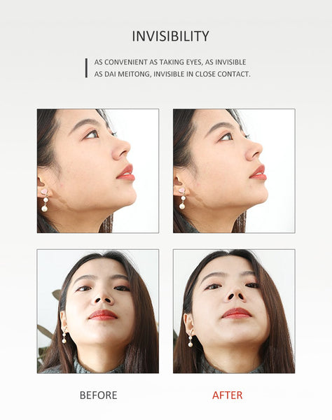 [MPTA00033] MEIPENG 3D beauty nose clip nose bridge augmenter nose pad nose augmenter invisible straightener