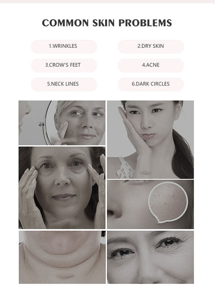 [MPTA00019] MEIPENG Micro-current Dolphin Ion Scraping Face Massager Lifting Tight Pulling Ribs to Guide Face-lifting Artifact of Beauty Instrument