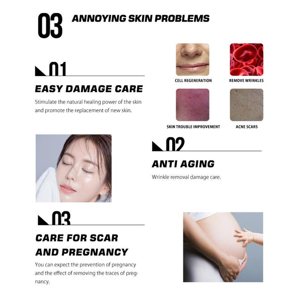 [MPTA00009]MEIPENG Micro Needle Roller Beauty Micro Needle Painless Micro Needle Roller Removing Acne, Whitening and Wrinkles