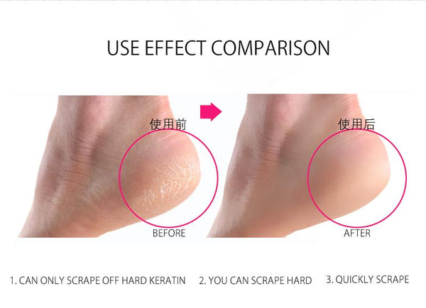 [MPTA00017]MEIPENG Antibacterial Glass Foot File Dead Skin Callus Remover Pedicure Scrubber