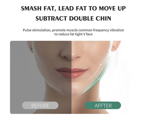 [MPTA00022]MEIPENG Micro current electronic face V face beauty instrument
